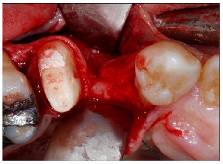 https://cdn.ncbi.nlm.nih.gov/pmc/blobs/c76d/7287986/a441ba2665bc/materials-13-02389-g002.jpg