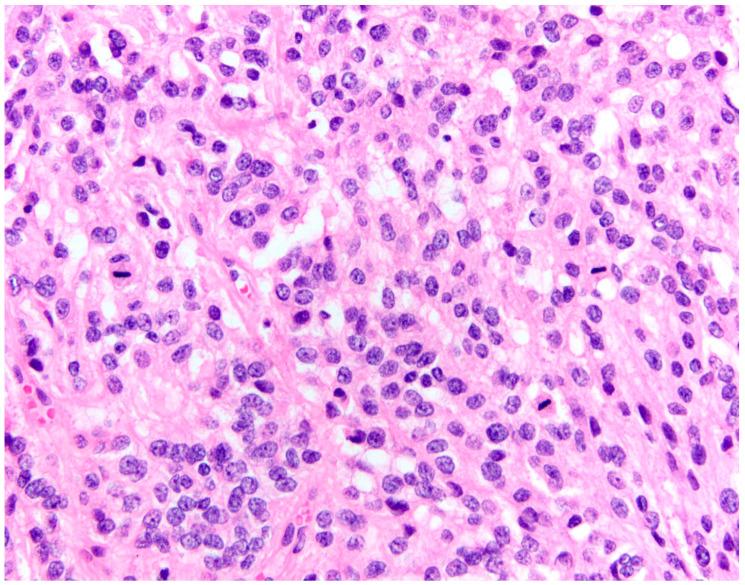 https://cdn.ncbi.nlm.nih.gov/pmc/blobs/c772/10486693/84c03dd126fe/cancers-15-04251-g002.jpg