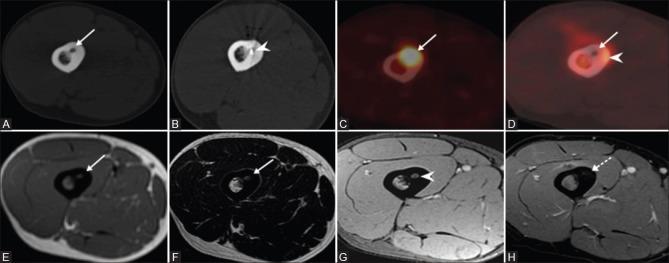 https://cdn.ncbi.nlm.nih.gov/pmc/blobs/c777/5644327/ae0fe18d2d1f/IJRI-27-318-g004.jpg