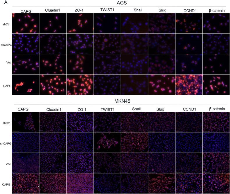 https://cdn.ncbi.nlm.nih.gov/pmc/blobs/c779/10774411/a74a2ed65ec4/41420_2023_1767_Fig7_HTML.jpg