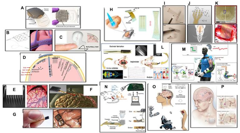 https://cdn.ncbi.nlm.nih.gov/pmc/blobs/c783/11293309/448c1935c638/fmed-11-1390634-g003.jpg