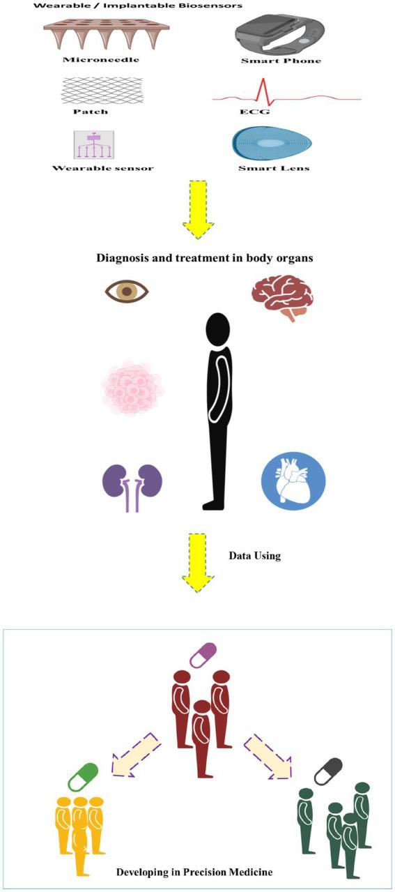 https://cdn.ncbi.nlm.nih.gov/pmc/blobs/c783/11293309/d21a6866034e/fmed-11-1390634-g001.jpg