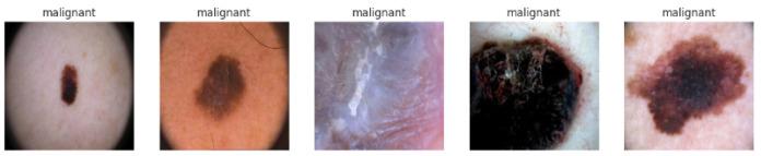 https://cdn.ncbi.nlm.nih.gov/pmc/blobs/c783/11720047/22c1c646b29b/diagnostics-15-00064-g002.jpg