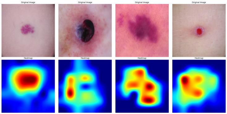 https://cdn.ncbi.nlm.nih.gov/pmc/blobs/c783/11720047/c79b2b576d8f/diagnostics-15-00064-g013.jpg