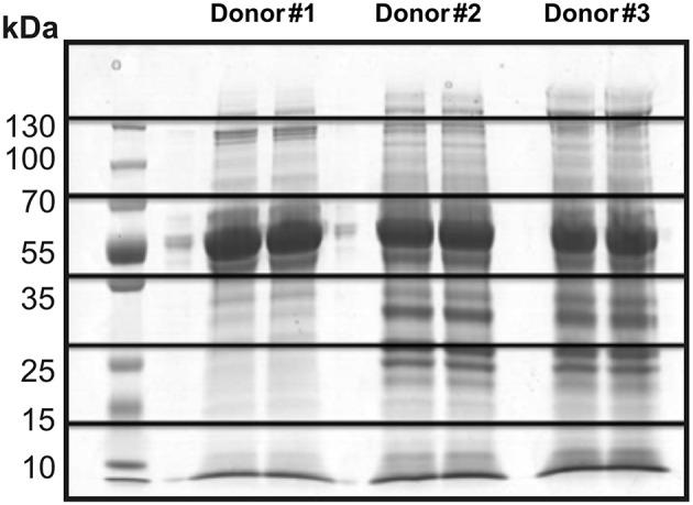 https://cdn.ncbi.nlm.nih.gov/pmc/blobs/c783/6607109/5cbbf5eeff94/fbioe-07-00154-g0002.jpg