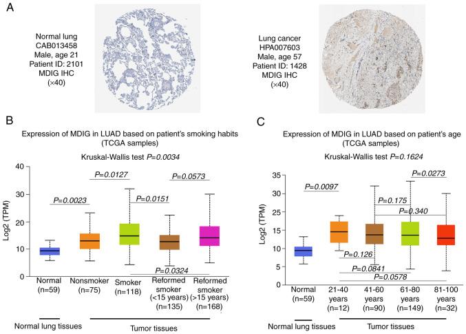 https://cdn.ncbi.nlm.nih.gov/pmc/blobs/c783/9162052/f9d81efe0ccb/IJO-61-01-05372-g01.jpg