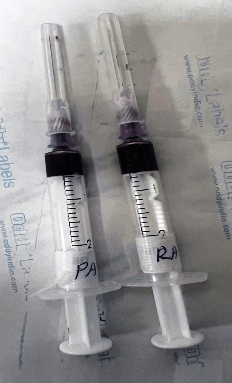 https://cdn.ncbi.nlm.nih.gov/pmc/blobs/c78c/9858716/e74801f462ae/cureus-0015-00000033942-i04.jpg