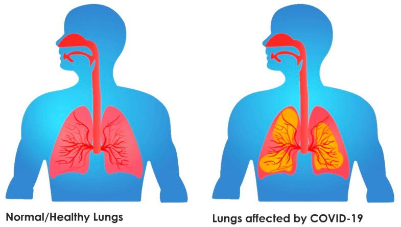 https://cdn.ncbi.nlm.nih.gov/pmc/blobs/c78d/8659534/b67b86e4fa84/sensors-21-08045-g001.jpg