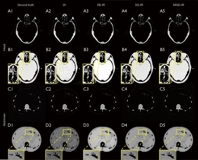 https://cdn.ncbi.nlm.nih.gov/pmc/blobs/c798/11151249/5cf654c5561a/qims-14-06-4155-f3.jpg