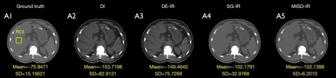 https://cdn.ncbi.nlm.nih.gov/pmc/blobs/c798/11151249/da3cba0d844f/qims-14-06-4155-f6.jpg