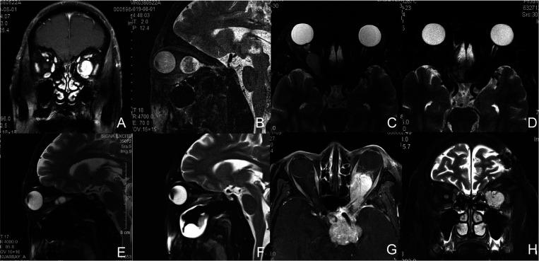 https://cdn.ncbi.nlm.nih.gov/pmc/blobs/c79e/9334750/10c52c3fcad3/fsurg-09-923712-g001.jpg