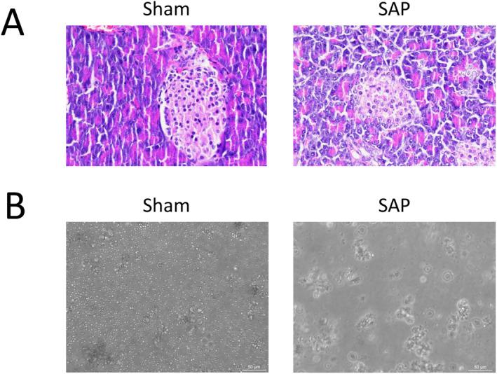 https://cdn.ncbi.nlm.nih.gov/pmc/blobs/c7a0/11211668/a44b57e984ea/JCLA-38-e25076-g004.jpg