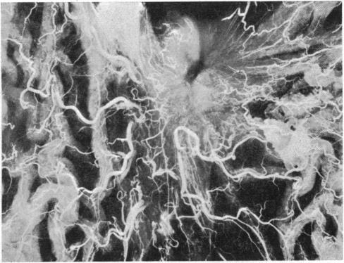 https://cdn.ncbi.nlm.nih.gov/pmc/blobs/c7a1/2039683/ce4ad7e18768/brmedj03579-0012-a.jpg