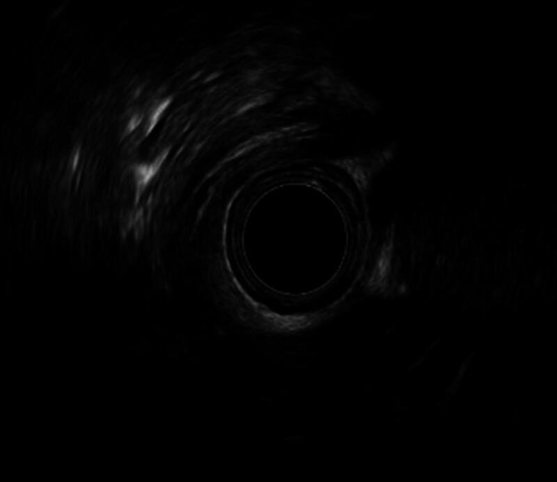 https://cdn.ncbi.nlm.nih.gov/pmc/blobs/c7a3/12338212/fe982025cd1a/medi-104-e43803-g002.jpg