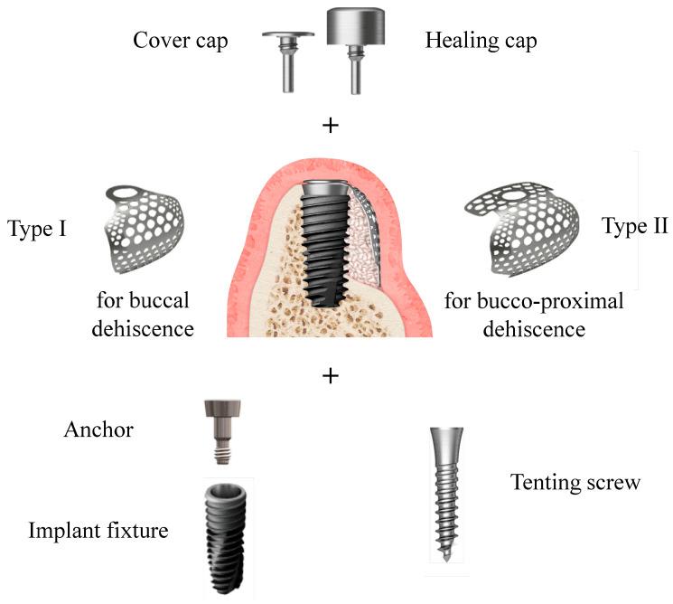 https://cdn.ncbi.nlm.nih.gov/pmc/blobs/c7a4/9369984/7bdc7955f838/materials-15-05294-g003.jpg