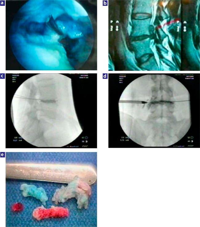 https://cdn.ncbi.nlm.nih.gov/pmc/blobs/c7a9/4365579/5d11d7d2082a/SAS-1-2006-0014-RR-g006.jpg