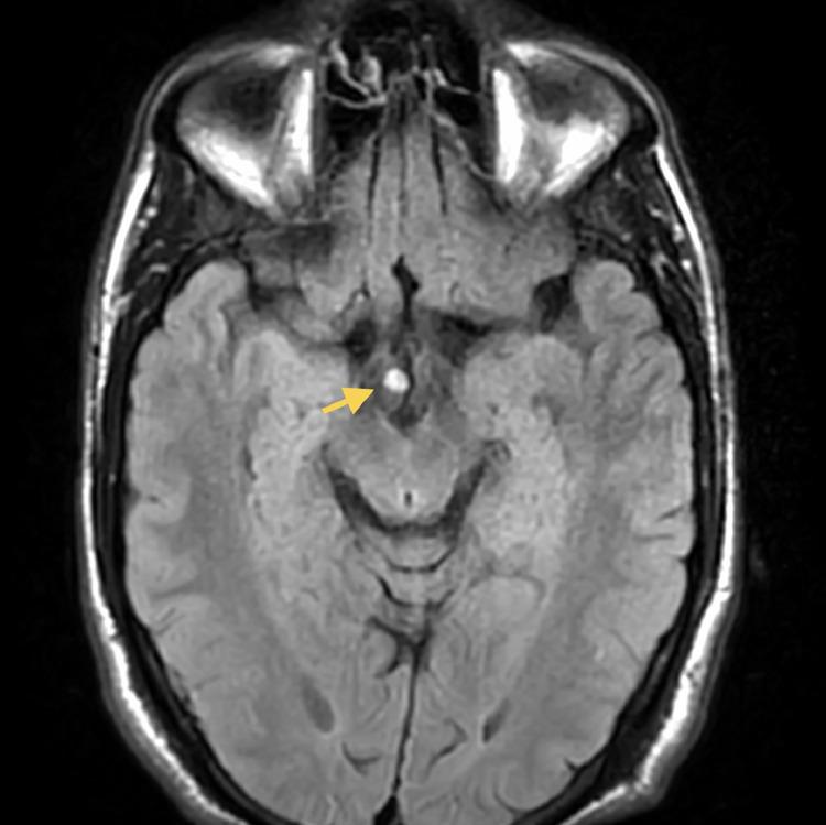 https://cdn.ncbi.nlm.nih.gov/pmc/blobs/c7b0/10698249/ae8ea3aea37c/gr3.jpg