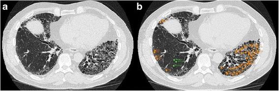 https://cdn.ncbi.nlm.nih.gov/pmc/blobs/c7b2/5340000/e056891e9e33/12931_2017_527_Fig2_HTML.jpg