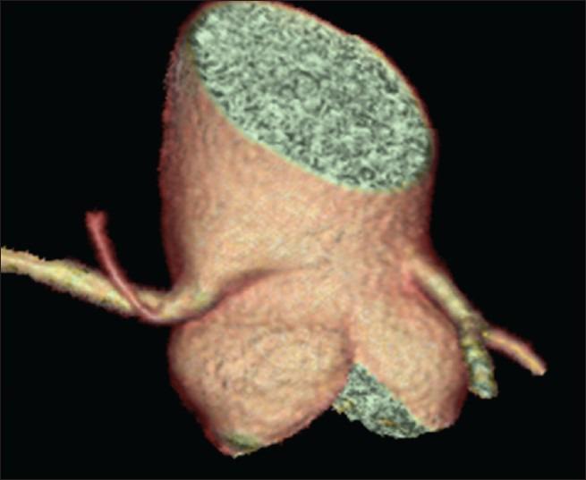 https://cdn.ncbi.nlm.nih.gov/pmc/blobs/c7b5/4837813/f694ae0b4d79/CMJ-128-15-g002.jpg