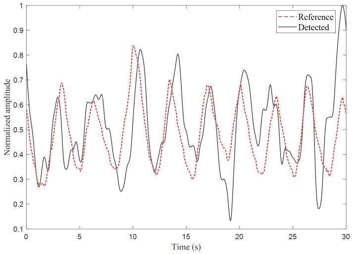 https://cdn.ncbi.nlm.nih.gov/pmc/blobs/c7b8/12196612/397e1e757b88/sensors-25-03766-g011.jpg