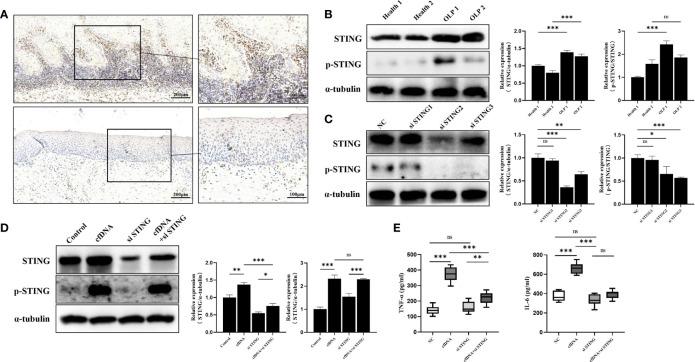 https://cdn.ncbi.nlm.nih.gov/pmc/blobs/c7c0/9049180/db7902140c12/fimmu-13-838109-g003.jpg