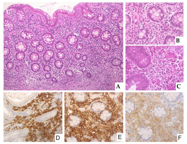 https://cdn.ncbi.nlm.nih.gov/pmc/blobs/c7c1/8269078/f7910b960144/cancers-13-03316-g001.jpg