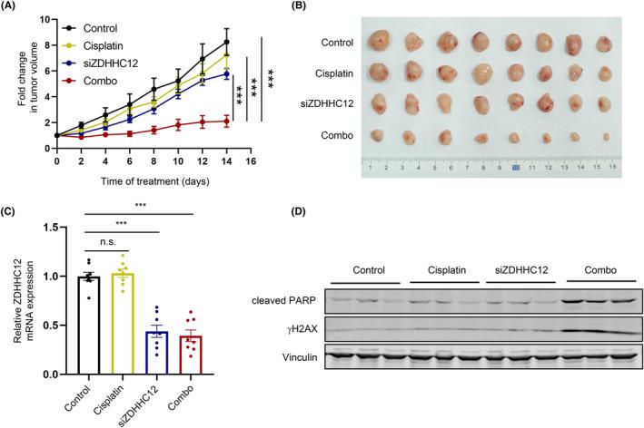 https://cdn.ncbi.nlm.nih.gov/pmc/blobs/c7c7/11007019/cced9ff2d1ed/CAS-115-1170-g006.jpg