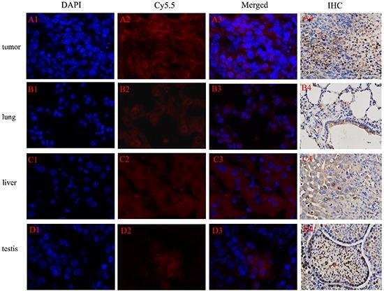 https://cdn.ncbi.nlm.nih.gov/pmc/blobs/c7d3/5129991/409a209d254d/oncotarget-07-40047-g010.jpg