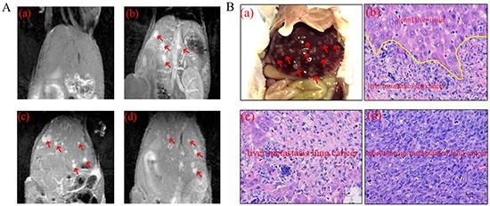 https://cdn.ncbi.nlm.nih.gov/pmc/blobs/c7d3/5129991/76bbfe6205f0/oncotarget-07-40047-g007.jpg