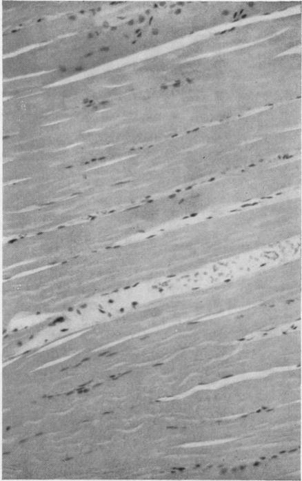 https://cdn.ncbi.nlm.nih.gov/pmc/blobs/c7d9/1010480/d90e4dd24bbb/annrheumd00233-0092-a.jpg