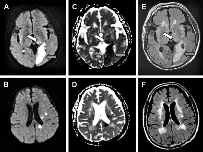 https://cdn.ncbi.nlm.nih.gov/pmc/blobs/c7da/5384735/bdc183c3157a/ndt-13-981Fig1.jpg