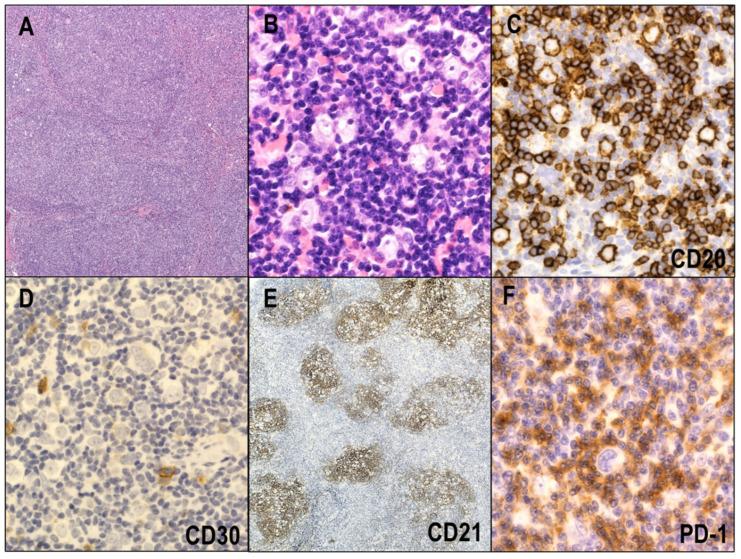 https://cdn.ncbi.nlm.nih.gov/pmc/blobs/c7da/9179292/53e7d131b6ec/cancers-14-02647-g006.jpg
