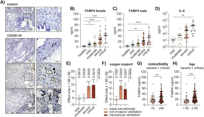 https://cdn.ncbi.nlm.nih.gov/pmc/blobs/c7dd/11904229/8d08e1ded33a/44321_2024_188_Fig1_HTML.jpg
