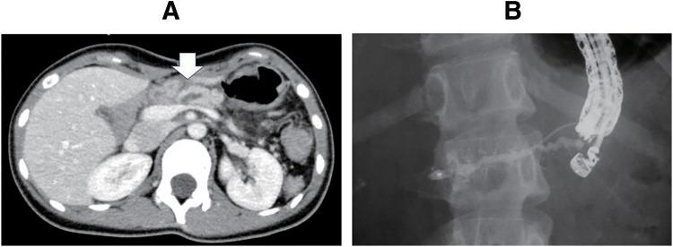 https://cdn.ncbi.nlm.nih.gov/pmc/blobs/c7e3/12086018/e743348dddb7/scr-11-01-25-0042-g001.jpg