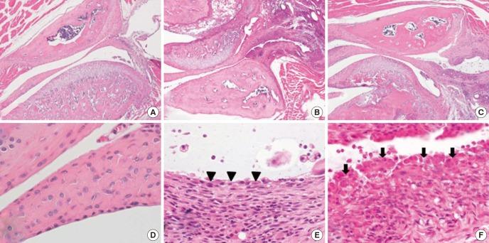 https://cdn.ncbi.nlm.nih.gov/pmc/blobs/c7e5/4414638/9ab3fdf56a10/jkms-30-552-g004.jpg