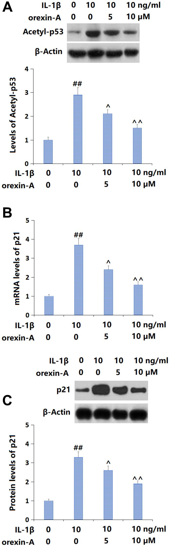 https://cdn.ncbi.nlm.nih.gov/pmc/blobs/c7e8/11210258/6594a70d21a5/aging-16-205884-g005.jpg