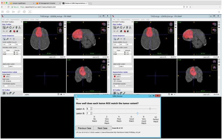 https://cdn.ncbi.nlm.nih.gov/pmc/blobs/c7e8/7567400/9e2c945ed299/JMI-007-055501-g001.jpg