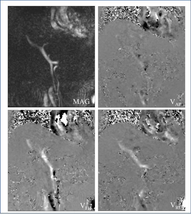 https://cdn.ncbi.nlm.nih.gov/pmc/blobs/c7e9/9587937/954a64a5b025/11547_2022_1553_Fig1_HTML.jpg
