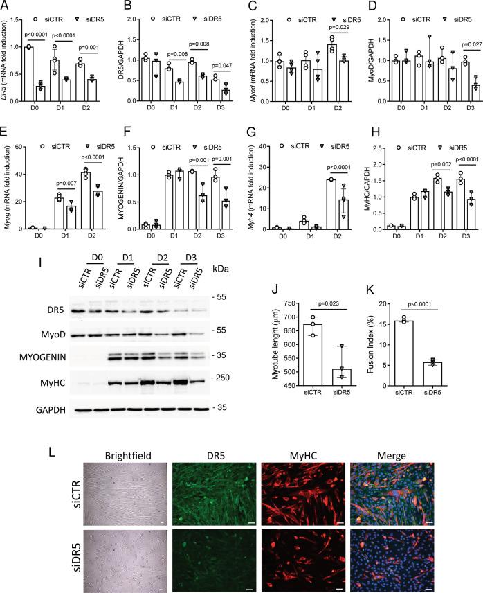https://cdn.ncbi.nlm.nih.gov/pmc/blobs/c7ea/8599458/39e623a832c6/41419_2021_4383_Fig3_HTML.jpg