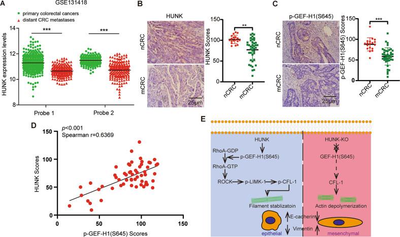 https://cdn.ncbi.nlm.nih.gov/pmc/blobs/c7ed/10188538/1753d299da8f/41419_2023_5849_Fig6_HTML.jpg