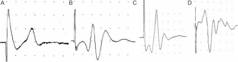 https://cdn.ncbi.nlm.nih.gov/pmc/blobs/c7f4/4192970/e68460ee780e/NRR-9-1525-g001.jpg