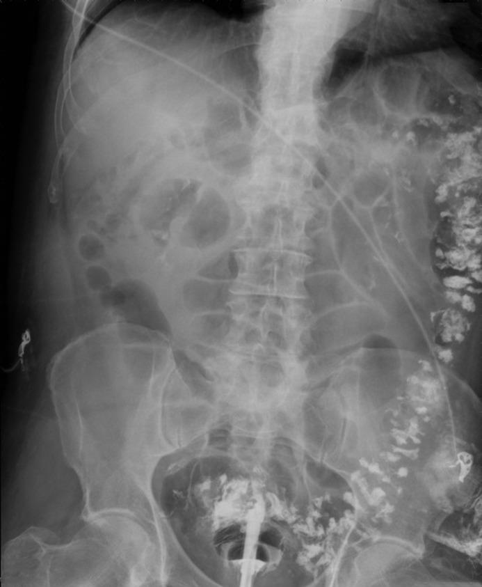 https://cdn.ncbi.nlm.nih.gov/pmc/blobs/c7f5/6160609/36067377f603/CG-CGCR180062F001.jpg