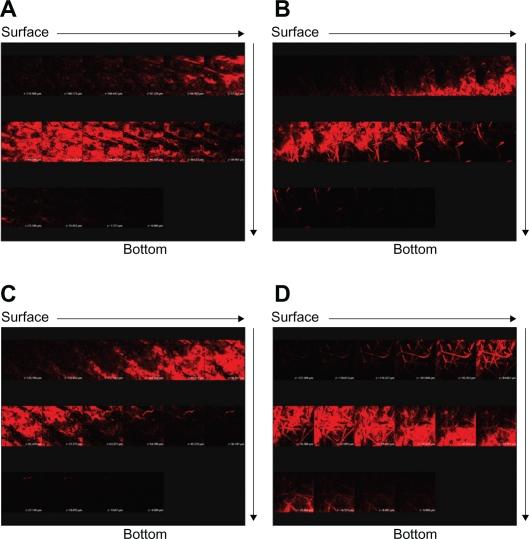 https://cdn.ncbi.nlm.nih.gov/pmc/blobs/c7f7/3084316/7022b8eb2ef8/ijn-6-693f5.jpg