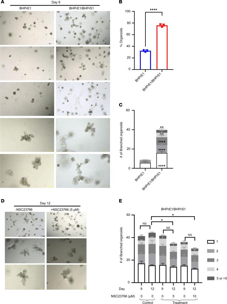 https://cdn.ncbi.nlm.nih.gov/pmc/blobs/c7f8/12220968/1e20700c2a4a/jciinsight-10-188062-g138.jpg