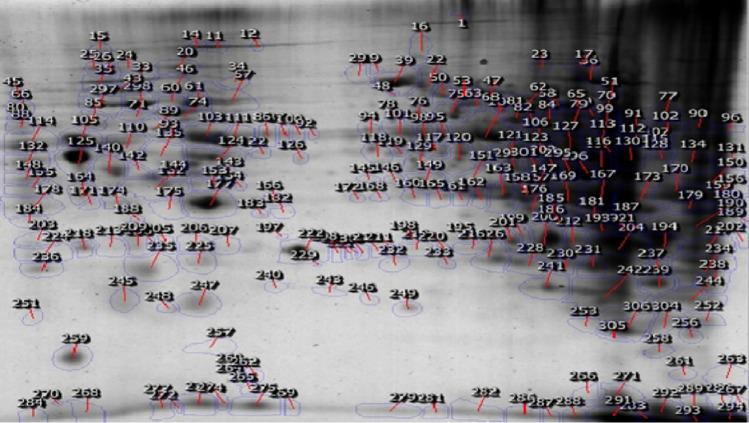 https://cdn.ncbi.nlm.nih.gov/pmc/blobs/c7f9/7574675/ad7719b29b55/705_2020_4845_Fig4_HTML.jpg