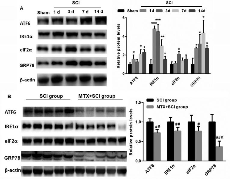 https://cdn.ncbi.nlm.nih.gov/pmc/blobs/c7fb/5921236/986722a7bb18/etm-15-05-4191-g04.jpg