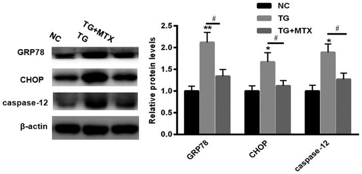 https://cdn.ncbi.nlm.nih.gov/pmc/blobs/c7fb/5921236/ed993ca68b3c/etm-15-05-4191-g01.jpg
