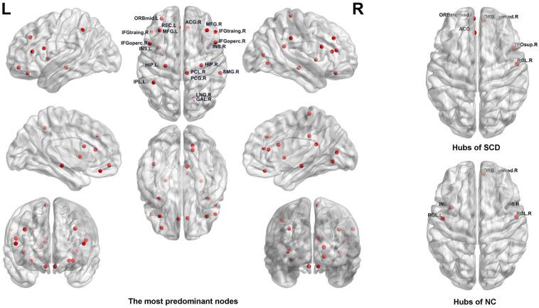https://cdn.ncbi.nlm.nih.gov/pmc/blobs/c806/7550635/183d2989bc17/fnins-14-577887-g004.jpg