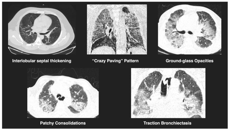 https://cdn.ncbi.nlm.nih.gov/pmc/blobs/c807/12155481/6da7155a722a/diagnostics-15-01430-g001.jpg
