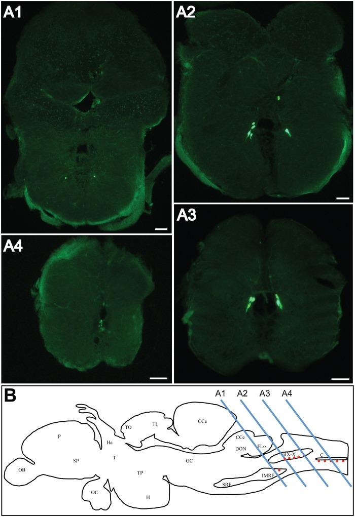 https://cdn.ncbi.nlm.nih.gov/pmc/blobs/c80f/4364556/5a4c02f08fe8/pone.0119290.g003.jpg